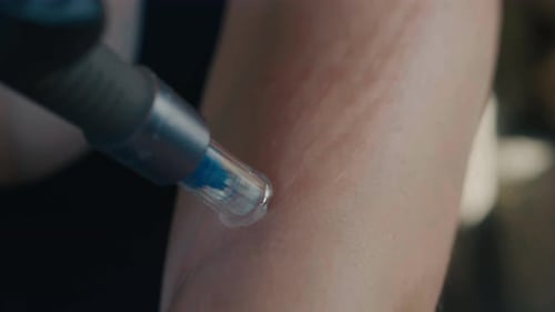 Device Treating Skin in Extreme Close Up