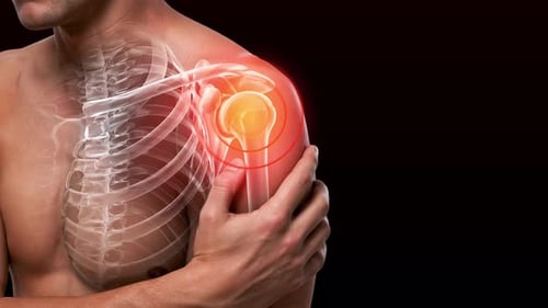 Shoulder Joint Pain Animation with Skeletal X-Ray Overlay