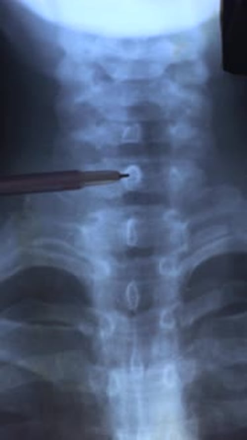 Medical X-Ray of Neck and Upper Chest