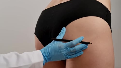 Doctor Marks Patient for Cosmetic Surgery