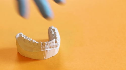 A dentist picks up and then places down a dental impression, for making invisible braces, bruxism, o