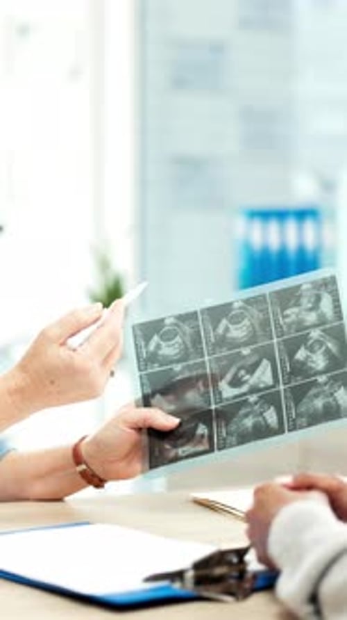 Discussion, mains et médecin lors d'une échographie de grossesse à l'hôpital pour révéler ou mettre à jour le sexe