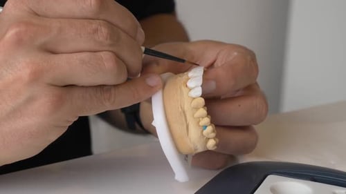 Detailed dental prosthesis preparation using precision tools in close up