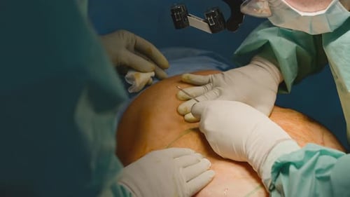 Close Up Males Hands in Protective Gloves Doing Surgery Operation Two Unrecognizable Men Doctors