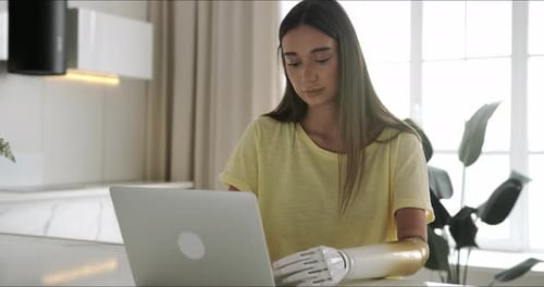 Woman Using Laptop with Prosthetic Arm in Kitchen