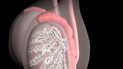 Germ Cell Tumor Growth Medical Anatomy Animation