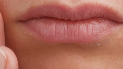 Eine Frau berührt ihre Lippen mit ihren Händen, Nahaufnahme, Abschälen der Haut