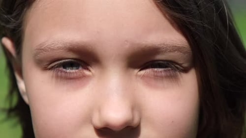 the Eyes of a Little Child Looking Directly Into the Camera on the Street on a Sunny Day