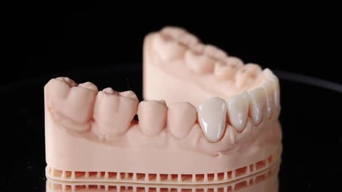 Dental Mold Showing Teeth on Black Surface