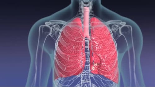 3D Animation of Human Lungs and Alveolar Disease Spread