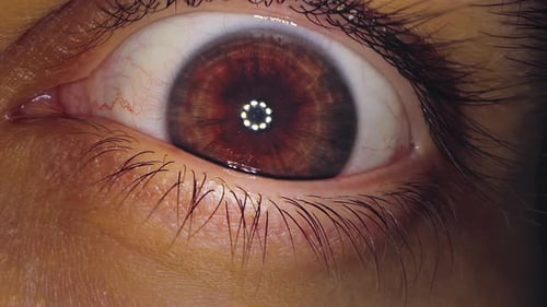 A Closeup of Eye in Which Light Shines From Medical Device Studying the Iris and Pupil