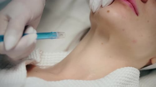 Facial Treatment for Skin Rejuvenation Aesthetic Procedure Using Pressurized Air to Deliver Active
