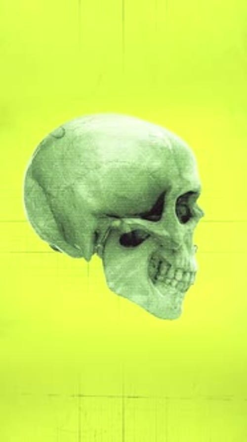 Medical Chart Skulls