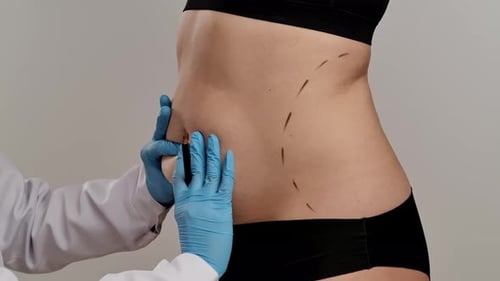 Doctor Marks Patient's Abdomen for Surgery