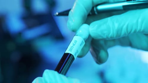 Laboratory Tubes with Blood and Virus Closeup of Scientific Lab in Hospital Epidemic Disease