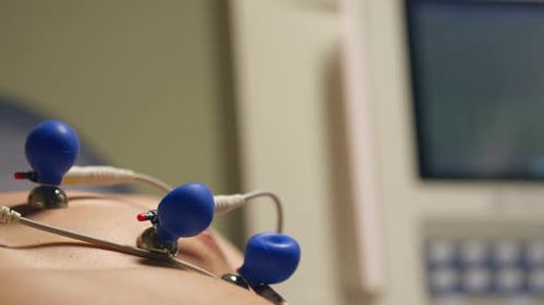 Close-up of ECG machine and electrodes during a medical exam