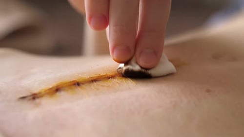 Abdomen of Young Girl Closeup Video of the Long Scar Above Navel After Abdominal Surgery for