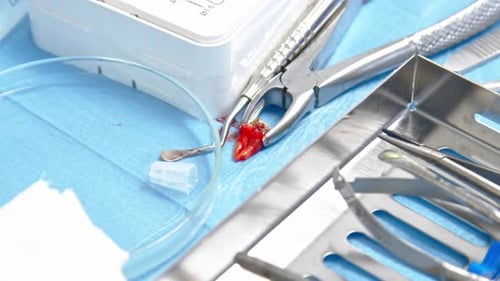 Extracted Tooth Held by Dental Plier