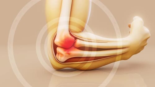 Animated Human Elbow Joint Showing Pain and Inflammation