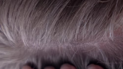 Macro View of Hair and Scalp Examination