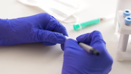 Medical Professional Marking Coronavirus Test as Positive