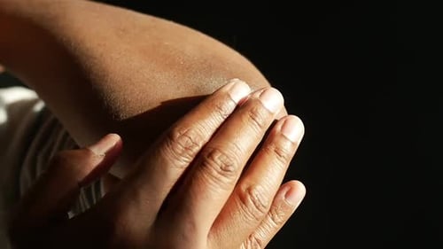 Aplicación de vaselina en el codo seco