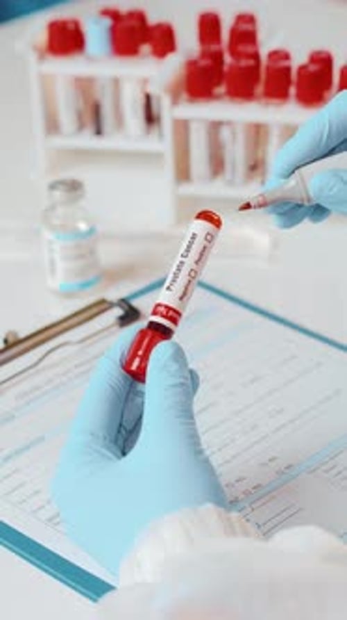 Marking a Prostate Cancer Test as Positive