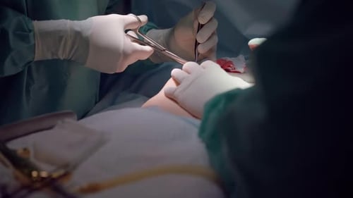 Unrecognizable Surgeon Using Surgical Forceps and Scissors in Slow Motion in Operating Room