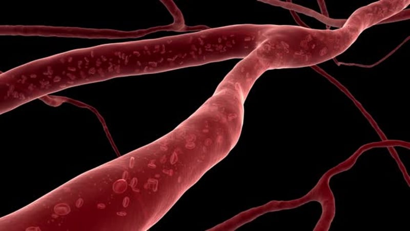 Artery Plaque Clearing in Blood Vessel Medical Animation, Backgrounds ...