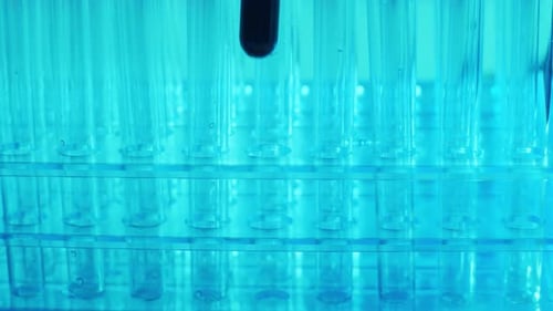 Laboratory Tubes with Blood and Virus Closeup of Scientific Lab in Hospital Epidemic Disease