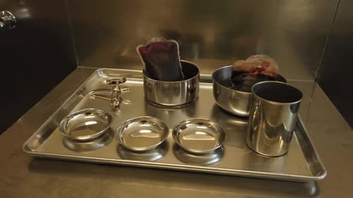 Medical Utensils and Blood Bag on Metal Tray