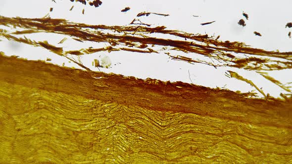 Silvering Pattern of Human Nerves Trunk in Longitudinal Section Filmed ...