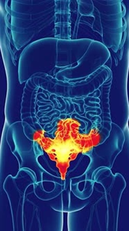 Animated X-Ray Scan of Human Intestines