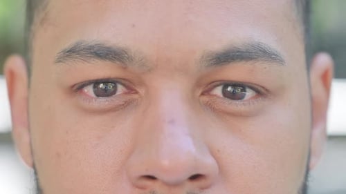 Waiting Young Woman Sitting in Park