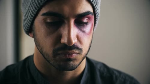 Souffrant, triste, homme latin blessé, regardant la caméra