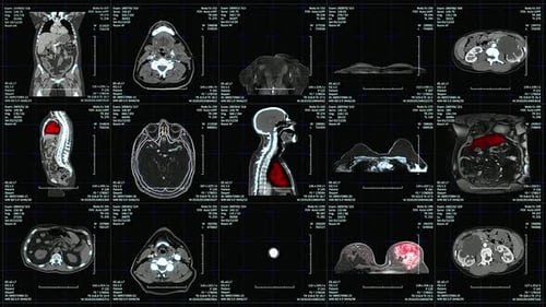 Pantalla de imágenes médicas que muestra varios escaneos y análisis anatómicos
