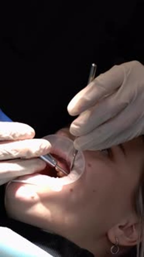 Dentist Using Drill on Patient's Teeth Close Up