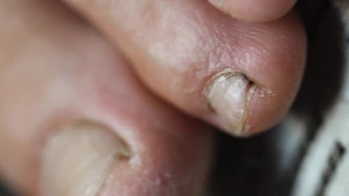 Close Up Studio Shot of Toes