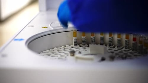 Automated blood sample analysis with lab equipment