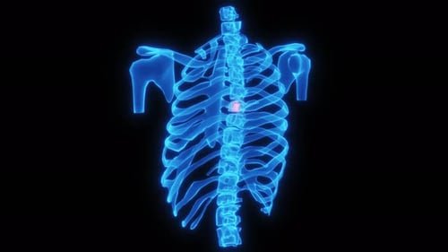 Pulsating Dull Pain in the Ribs Skeletal Rotate Endless