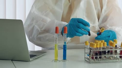 Researchers or scientists compare blood samples of patients infected with the disease.