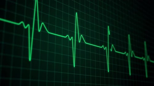 Patient Monitor Displays Vital Signs ECG Electrocardiogram EKG Oxygen Saturation SPO2 and