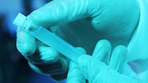 Laboratory Tubes with Blood and Virus Closeup of Scientific Lab in Hospital Epidemic Disease