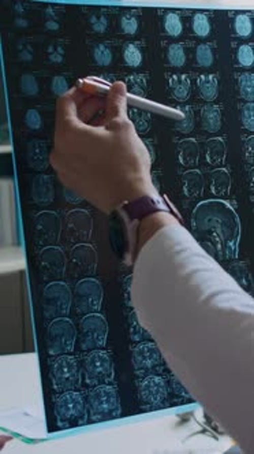 Examining Brain Scan in Medical Setting