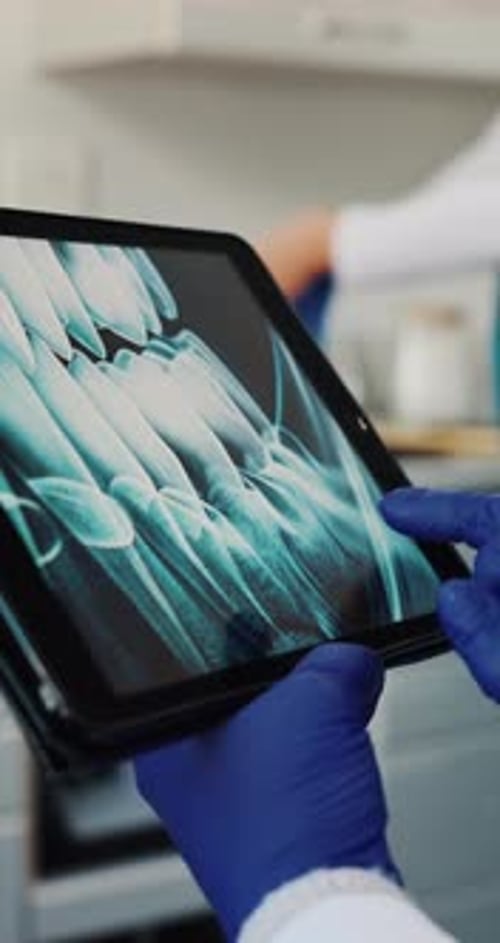 Zahnarzt, Hand- oder Tablet-Bildschirm mit Mundröntgen für Zahnchirurgie, Karies oder Extraktion in der Klinik