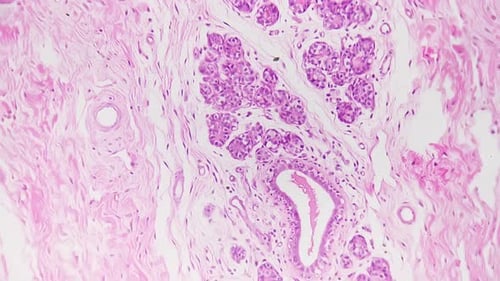 Tecido bronquíolo humano filmado sob microscópio com ampliação de 100x contra campo brilhante