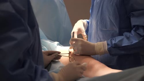 Cirujano vascular con asistente realiza una operación para extirpar las venas varicosas