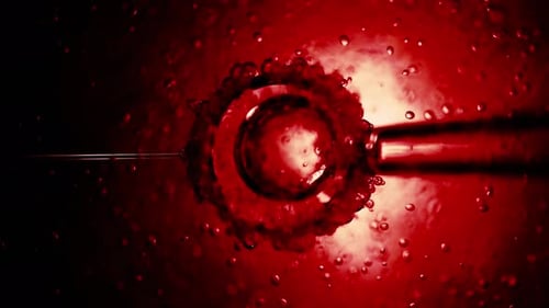 IVF in vitro fertilization through a microscope. Intracytoplasmic sperm injection