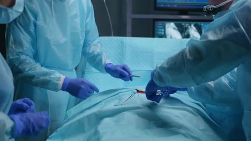 Team of Professional Medical Surgeons Performs the Surgical Operation in a Modern Hospital Doctors