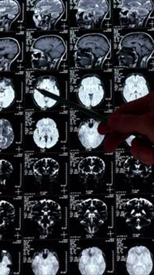Vertical footage of a Doctor examining MRI CT scan